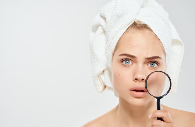10 solutions pour se débarrasser des boutons !