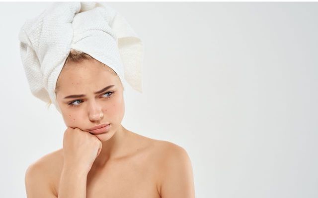 Acné hormonale : quelles sont les meilleures solutions ?